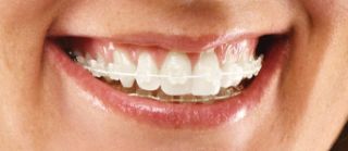 cosmetic dentist evansville Reliant Family Dental: Chris Meunier, DDS